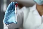 Group invests $1.9m to fast-track Bundibugyo Ebola vaccine development