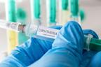Plateau records 148 suspected diphtheria cases, 23 deaths