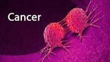 Early cancer diagnosis improves chances of effective treatment, outcome – FG