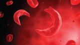 Sickle cell graduate calls for non-kinetic solutions to tackle insecurity