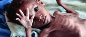 FG to address malnutrition in pregnant Women