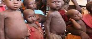 MSF links malaria to child malnutrition in Nigeria