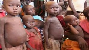 New wave of malnutrition and the road to 2027