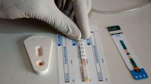 Ogun begins 2025 integrated pediatric TB/HIV testing week