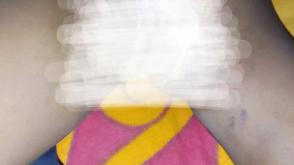 Bauchi minor in severe pain after housewife burnt her private part with knife 