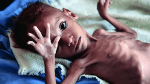 FG to address malnutrition in pregnant Women