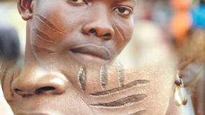 Facial tribal marks: An ancient cultural heritage lost to modernization