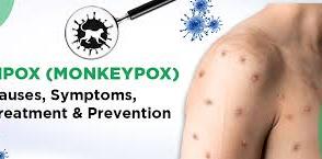 M-Pox cases have increased, with Cross River and Lagos being among the most affected area
