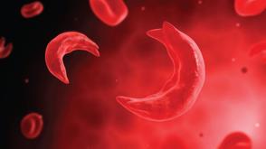 Sickle cell graduate calls for non-kinetic solutions to tackle insecurity