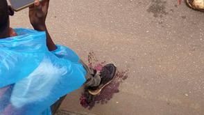 Dispatch rider suffers severe leg injury in crash near Abule Egba Bridge
