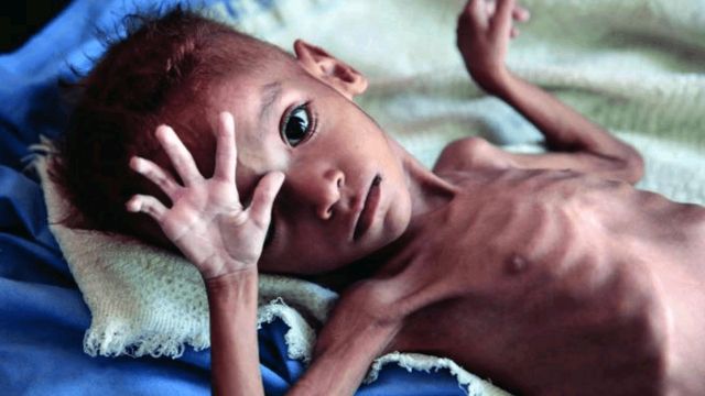 FG to address malnutrition in pregnant Women