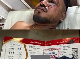 Lone survivor recounts ordeal as Air India crash claims over 200 lives