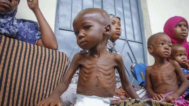 Benue faces worsening child malnutrition crisis – Official