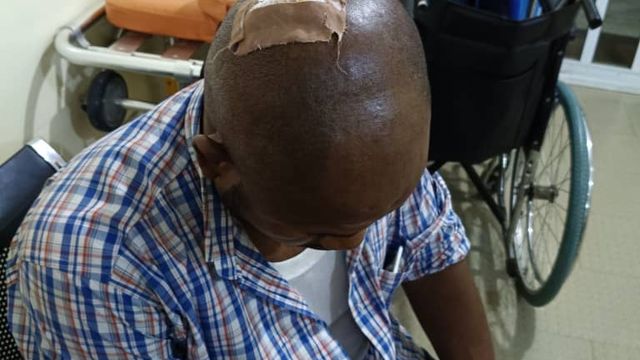 AEDC officials injured during anti-power theft operation at Dawaki Police quarters
