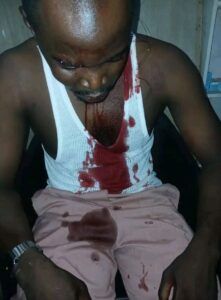 Kaduna APC condemns violence against members, demands police probe