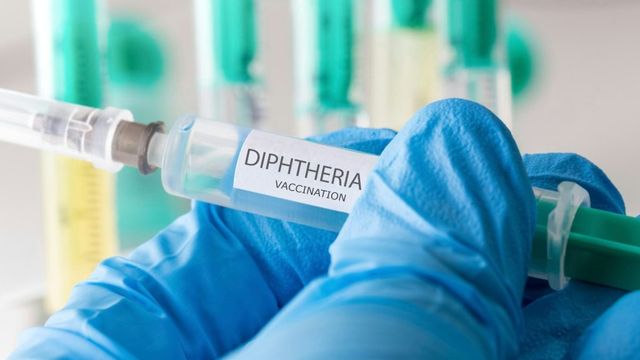 Plateau records 148 suspected diphtheria cases, 23 deaths