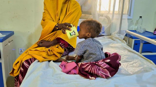 ICRC reports 18% rise in malnutrition cases in Northeast Nigeria