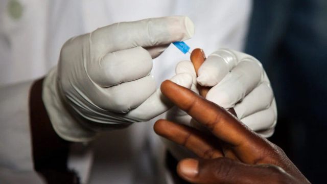Better data, political will boost Nigeria’s HIV treatment coverage — Expert