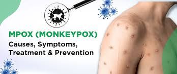 M-Pox cases have increased, with Cross River and Lagos being among the most affected area