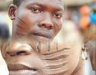 Facial tribal marks: An ancient cultural heritage lost to modernization