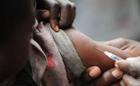 20m measles deaths averted since 2000 in Africa – WHO