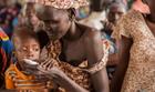 Worsening hunger pushing millions closer to famine in 13 global hotspots -UN warns
